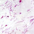 Clostridium septicum