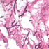 Aspergillus fumigatus