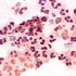 Neisseria gonorrhoeae