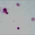 Herpesvirus 8, Human (KSHV)