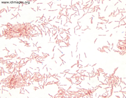 Figure 1. Gram stain of <i>Legionella pneumophila</i>, from culture of a sputum specimen.