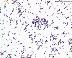 Figure 1. Gram stain of throat culture, showing <i>Corynebacterium diphtheriae</i>.