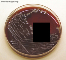 Figure 2. <i>Corynebacterium diphtheriae</i> growth on blood agar.