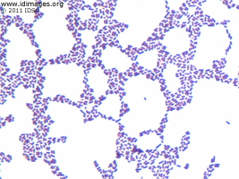 Figure 1.  Gram stain of culture growth of  cerebrospinal fluid, showing <i>Listeria monocytogenes</i>.