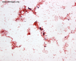 Figure 2.  Gram stain of blood culture growing  <i>Listeria monocytogenes</i>.