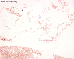 Figure 1.  Gram stain of stool subculture, showing  <i>Campylobacter jejuni</i>.