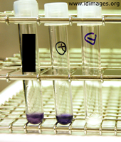 Figure 3. Positive tube test for Campylobacter on left, negative control on right and positive control in the middle.