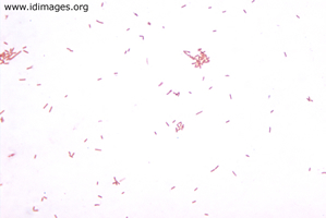 Figure 1.  Gram stain of <i>Eikenella corrodens</i>, grown in anaerobic blood culture bottle.