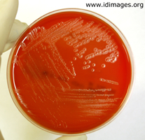 Figure 2.  <i>Eikenella corrodens</i> on blood agar plate.