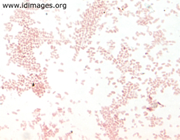 Figure 1.  Gram stain of <i>Haemophilus influenzae</i> type b.