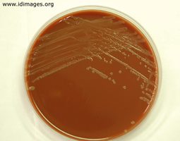 Figure 2.  <i>Haemophilus influenzae</i> type B on chocolate agar plate.