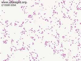 Figure 1.  Gram stain of <i>Klebsiella pneumoniae</i> ssp. rhinoscleromatis.
