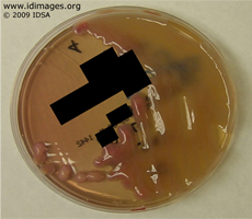Figure 4.  Hypermucoviscous colonies of  <i>Klebsiella pneumoniae</i> on MacConkey agar.