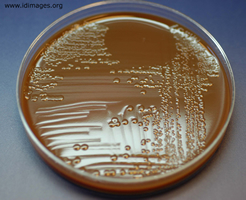 Figure 2.  <i>Neisseria meningitidis</i> colonies on  chocolate agar plate.