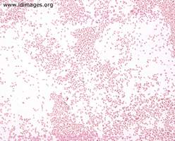 Figure 1.  <i>Pasteurella multocida</i> shown with  Gram stain of culture growth. 