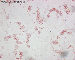 Figure 1. <i>Salmonella typhi</I>, shown by gram  stain of blood culture. 