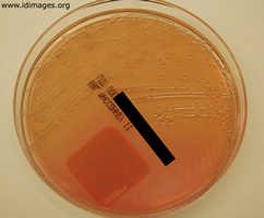 Figure 2. <i>Salmonella typhi</I>, shown on  MacConkey agar subculture.