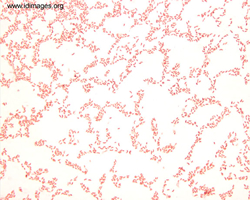Figure 1.  Gram stain of non-01 <i>Vibrio cholerae</i>,  non-cholera toxin producing.