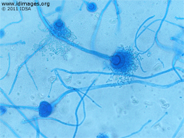 Figure 1.  Fungal stain of culture of  <i>Aspergillus fumigatus</i>.