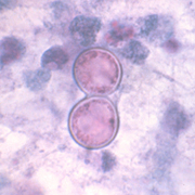 Blastomyces