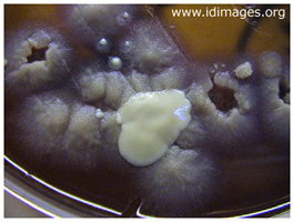 Figure 2. <i>Blastomyces dermatitidis</i> gray granular  colonies, with creamy white <i>Candida albicans</i> colonies.