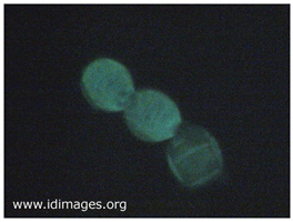 Figure 3.  <i>Blastomyces dermatitidis</i> fluorescent  stain of gray colony growth.