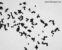 Figure 2.  Gram stain showing Cryptococcus in cerebrospinal fluid.