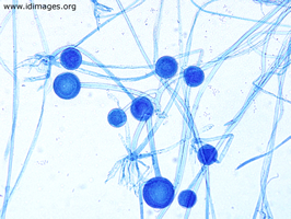 Figure 2.  Rhizopus, by lactophenol cotton blue  stain of culture growth.