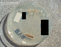 Figure 2.  <i>Sporothrix schenckii </i> colonies on culture  plate.  
