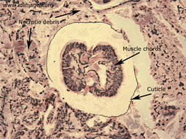 Figure 3.  Dirofilarial nematode seen in cross-section  by reticulin stain.