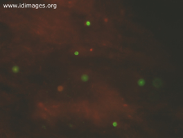 Figure 1.  Cryptosporidium oocytes seen by direct immunofluorescence