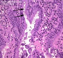 Figure 2.  Cryptosporidium on hematoxylin and eosin stain of gallbladder (arrows).
