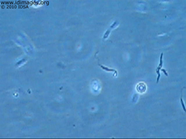 Figure 3.  <i>Leishmania guyanensis</i>, from skin biopsy  tissue grown in Schneider’s medium.