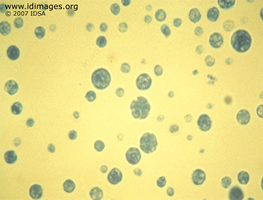 Figure 1.  <i>Prototheca wickerhamii</i>, Papanicolaou  stain of growth from elbow aspirate.