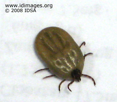 Figure 1.  Tick removed from skin of child with  tick paralyisis.