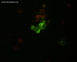 Figure 1.  Immunofluorescent stain of herpes simplex virus from culture.