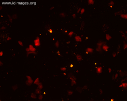 Figure 1.  RSV staining red (TRITC), pool  antibodies in green.