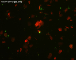 Figure 3.  RSV with FITC tag, apple-green  fluorescence.