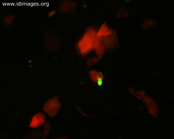 Figure 4.  Detail of Figure 3,  RSV with FITC tag,  apple-green fluorescence.