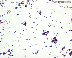 Figure 1.  <i>Arcanobacterium haemolyticum</i> on gram stain of growth from throat culture.