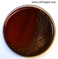 Figure 1. <i>Bacteroides fragilis</i> in Brucella Laked Sheep Blood Agar with kanamycin and vancomycin in culture.