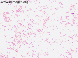 Figure 2.  <i>Bacteroides fragilis</i> seen on gram stain of blood culture growth.