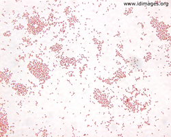 Figure 1.  <i>Bordetella pertussis</i> on gram stain of sputum culture.