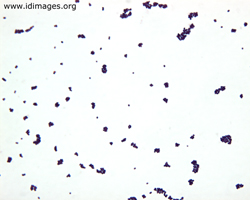 Figure 1. <i>Enterococcus</i> shown by gram stain.