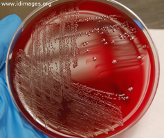 Figure 3.  <i>Enterococcus faecalis</i> colonies on trypticase soy agar (TSA) with sheep blood. 
