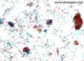 Figure 2.  Giardia cyst, trichrome stain with PVA fixative, under oil (100x magnification).