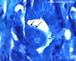 Figure 1.  <i>Helicobacter pylori</i> seen on thiazine stain of biopsy of the gastric antrum.
