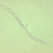 Ancylostomatoidea (Hookworm)