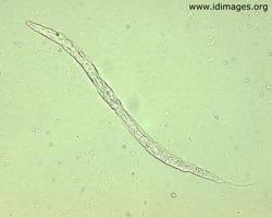 Figure 1.  Hookworm rhabditiform larvae (40x magnification).