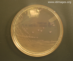 Figure 1.  <i>Shigella</i> colonies on MacConkey agar plate.